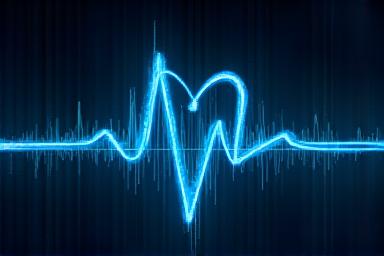 Visualisation d'un électrocardiogramme (ECG) analysé par IA.